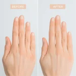 Natural Nail Treatment