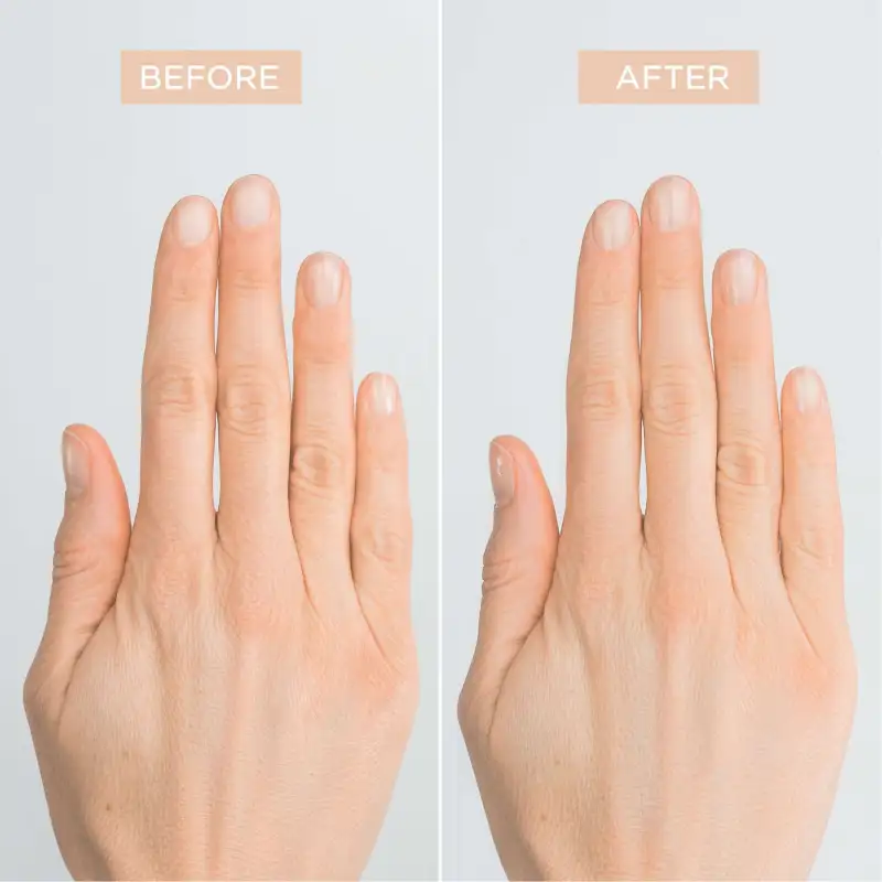 Natural Nail Treatment