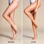 Spray On Leg Foundation