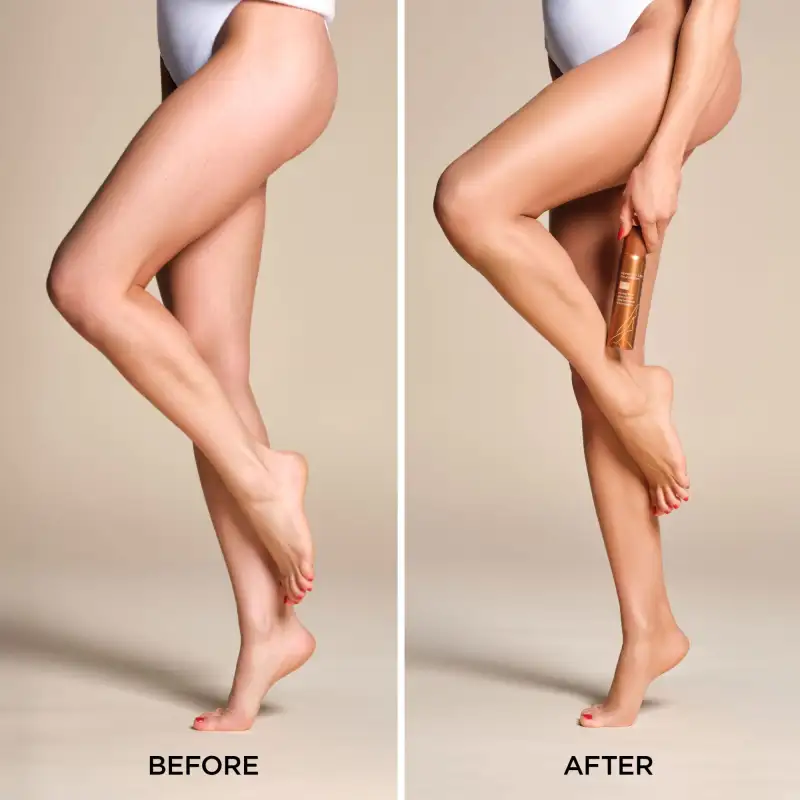 Spray On Leg Foundation